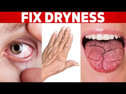 Shingles Natural Relief