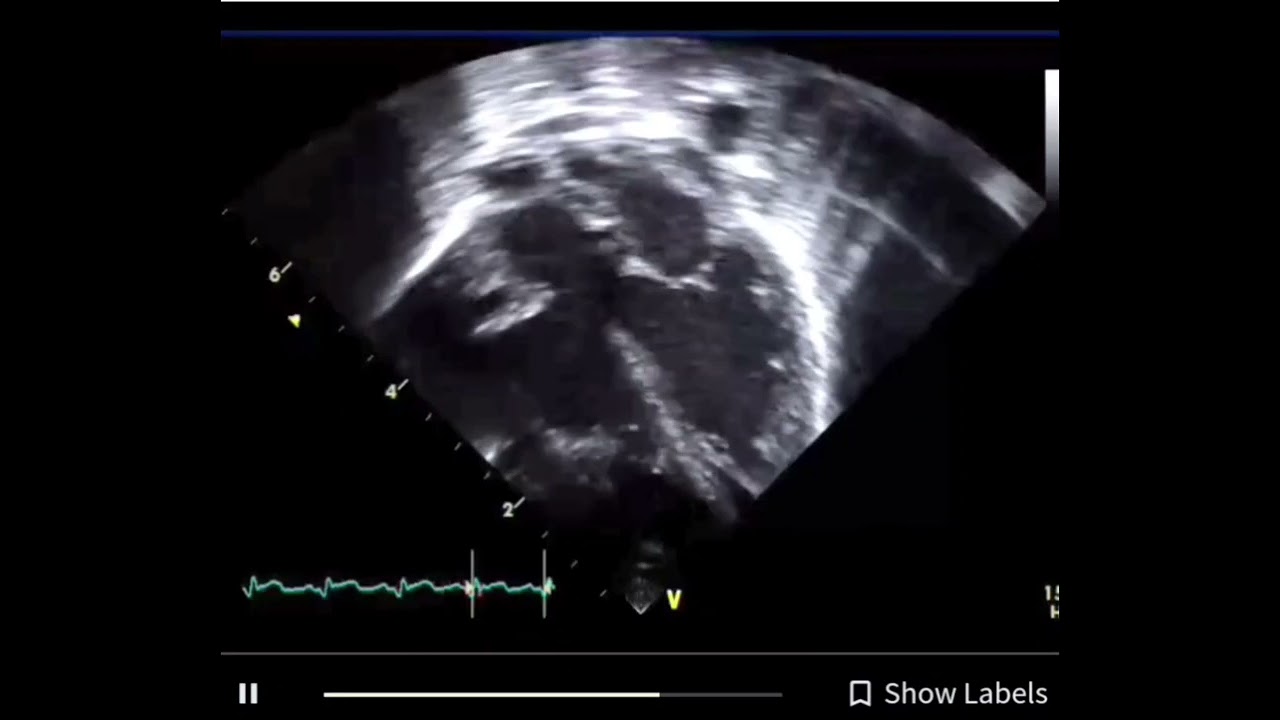 Carlos Mario Balcazar Ochoa-6