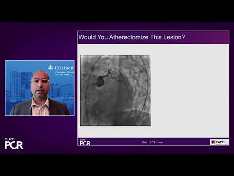 Incorporating coronary orbital atherectomy to my practice - EuroPCR 2022