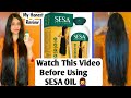 Sesa Hair Oil Review In Hindi| How To Use Sesa Oil ? Hair oil to grow longer hair | My Honest review