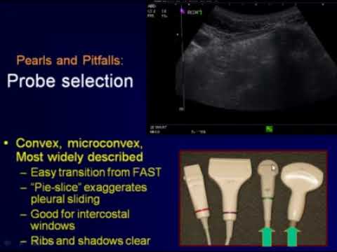 Ultrasound Evaluation for Pneumothorax