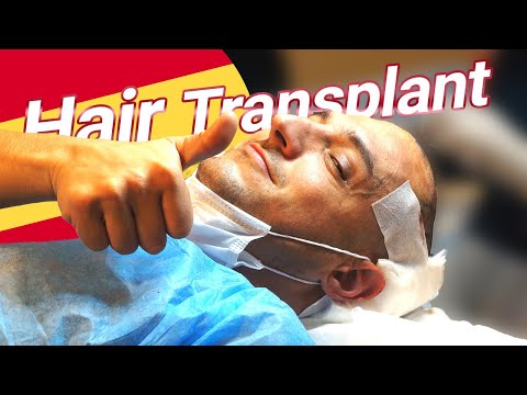 Hair Transplantation Steps in IstanbulVita