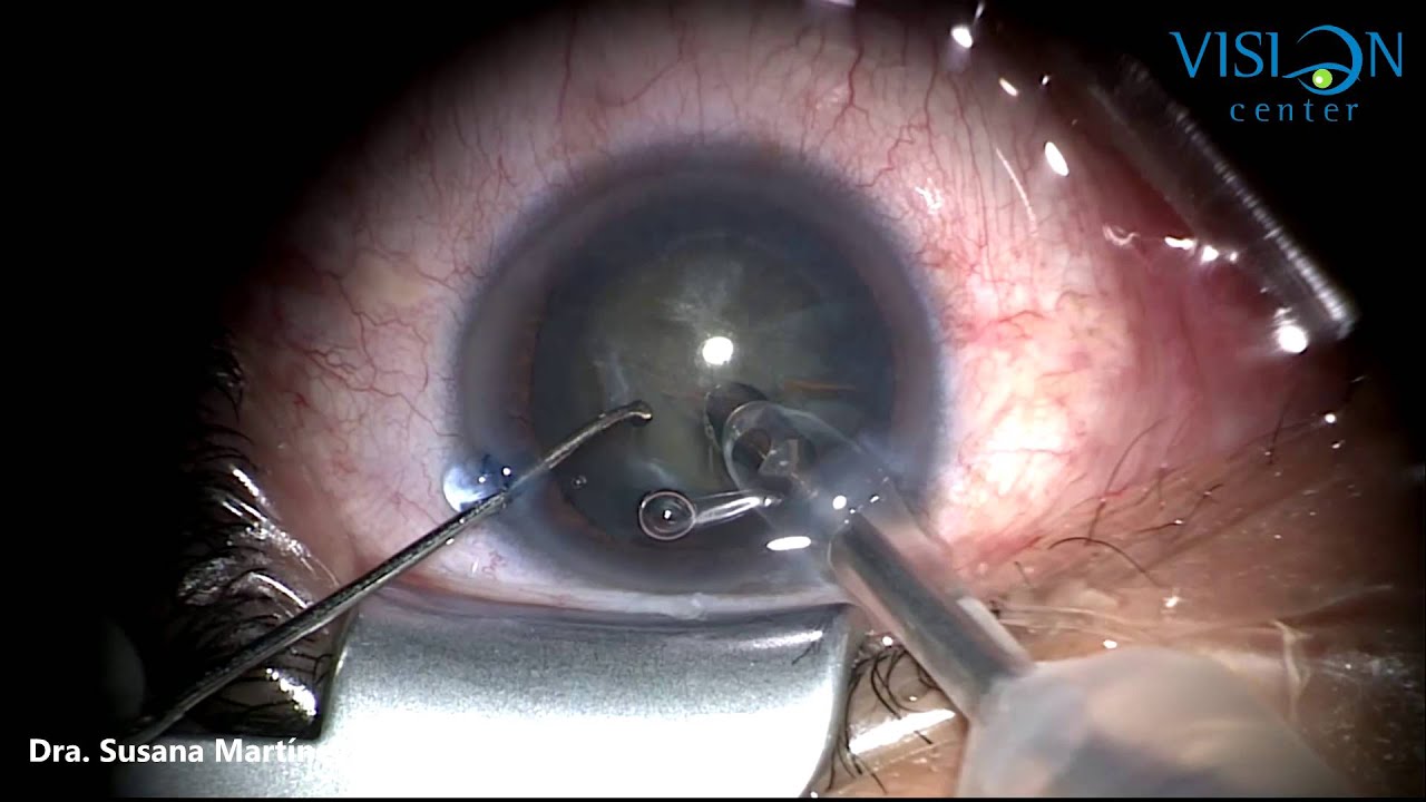 C. Susana Martinez Jardon-19