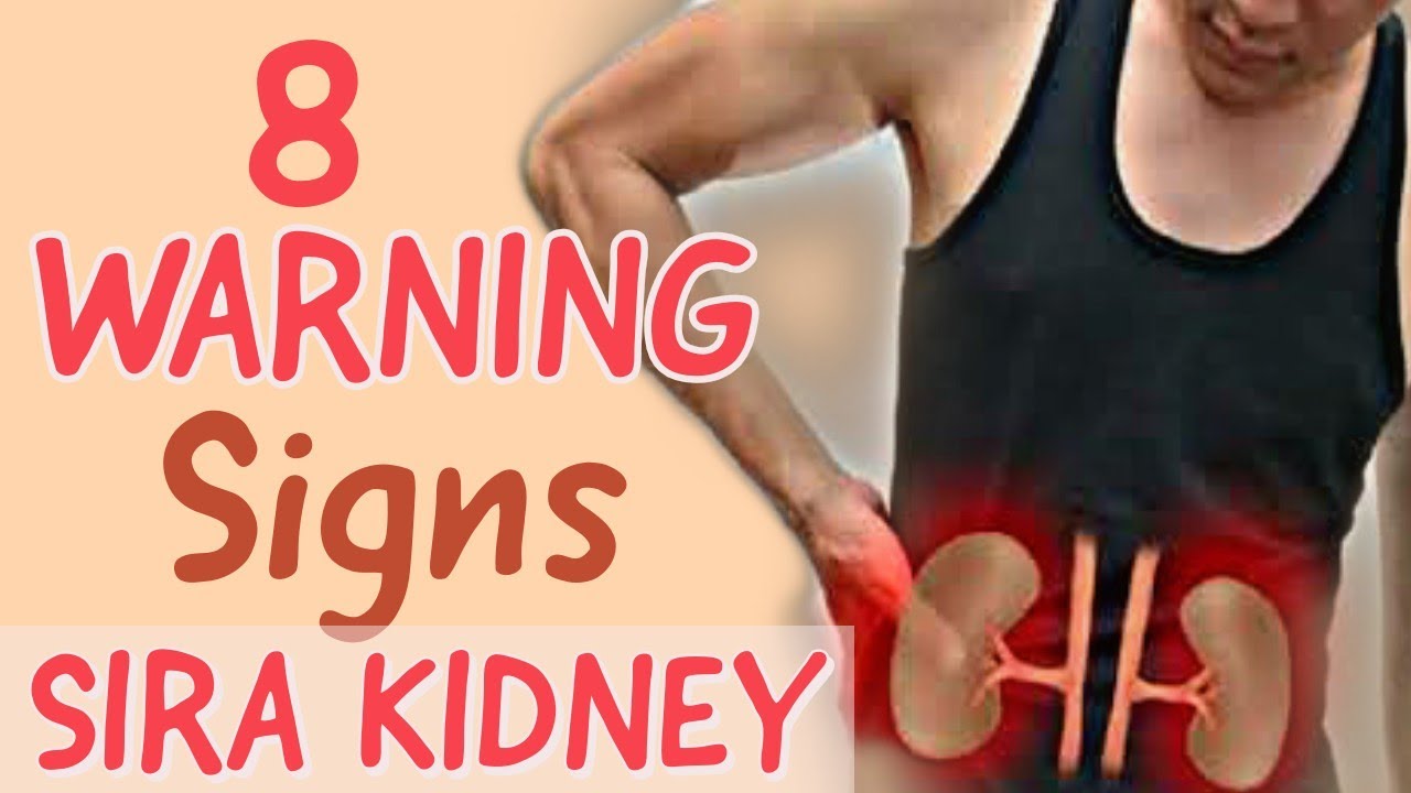 Putar video 8 Warning Signs na Sira ang Kidney - Payo ni Doc Willie Ong #127 sekarang 8 Warning Signs na Sira ang Kidney - Payo ni Doc Willie Ong #127