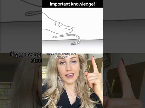 How to remove a fish hook