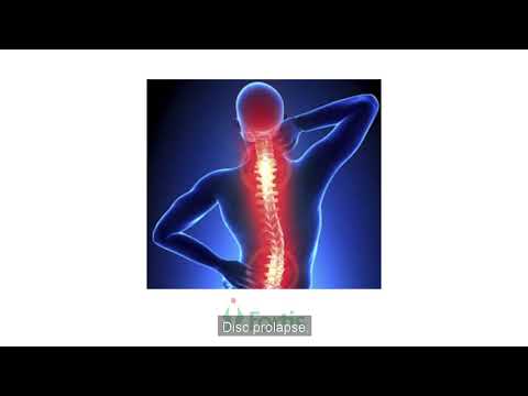 download lagu mp3 mp4 Neurologist Doctor In Jaipur, download lagu Neurologist Doctor In Jaipur gratis, unduh video klip Neurologist Doctor In Jaipur