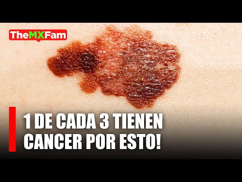 1 de cada 3 personas que consumen esto tienen cáncer | TheMXFam