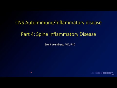 Imaging CNS autoimmune and inflammatory disease - 4 - Spine inflammatory disease