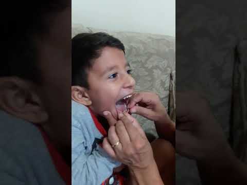 Tirando o Dente de Leite do Enzo Masetti