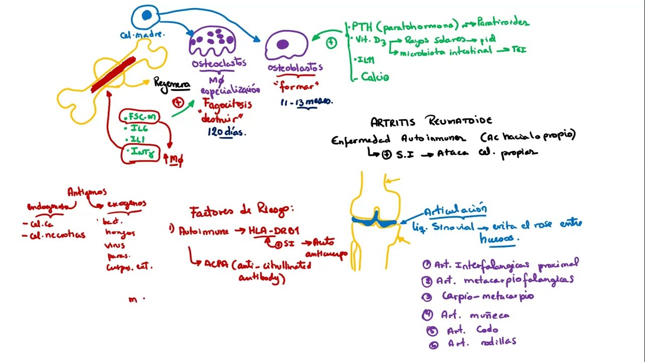 ARTRITIS REUMATOIDEA