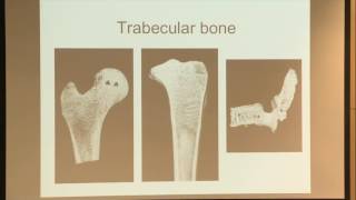 11. Trabecular Bone and Osteoporosis