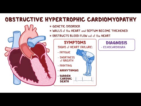 Hypertrophic Cardiomyopathy Explained: Symptoms, Causes & Treatments