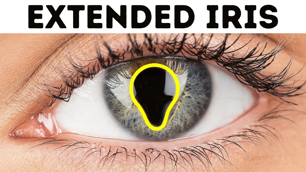 30+ Rarest Body Features You Might Have or Not