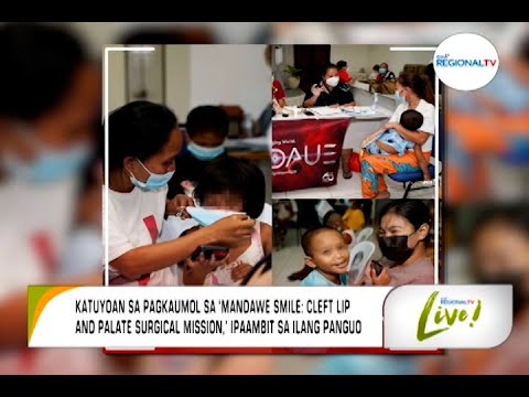 GMA Regional TV Live: 'MandaWe Smile: Cleft Lip and Palate Surgical Mission'