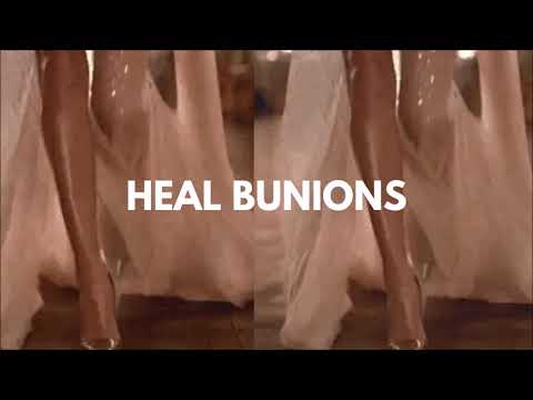 heal bunions