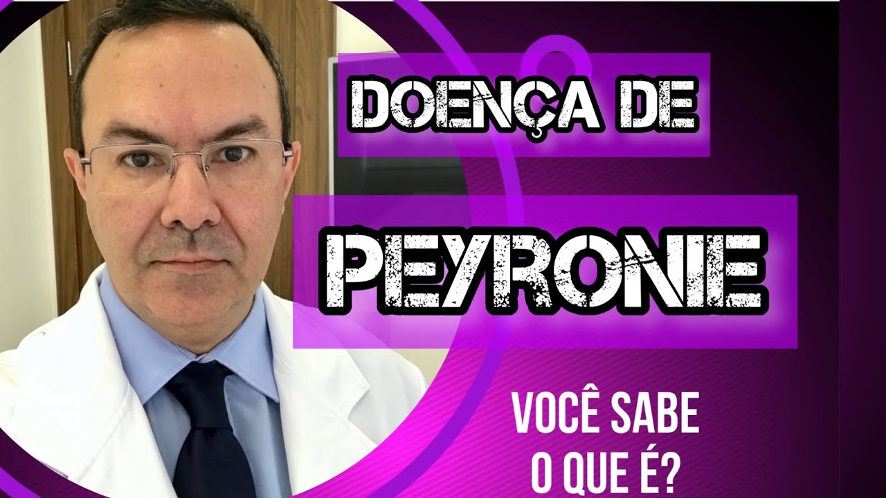 Leonardo De Souza Alves-62