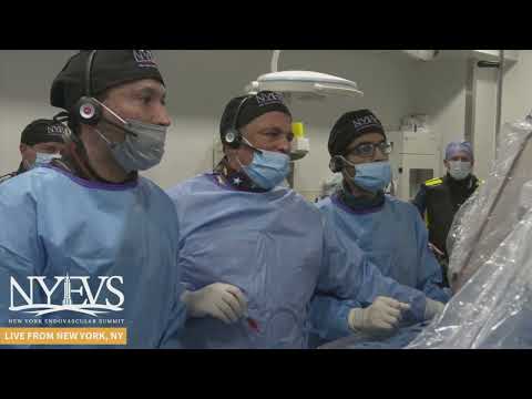 Live Case: Complex SFA CTO and BTK Treatment