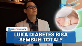 Jawaban Dokter soal Luka pada Kaki Penderita Diabetes, Apakah Bisa Sembuh Total?