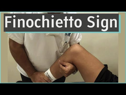Finochietto Sign | ACL & Meniscus Tear