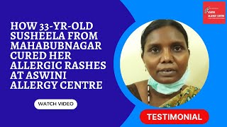 Skin Allergy Recovery | Mahabubnagar Patient
