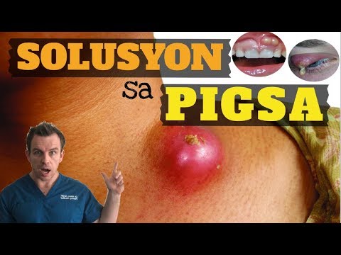 download lagu mp3 mp4 Tigsa, download mp3 Tigsa free download mp3, download mp3 Tigsa