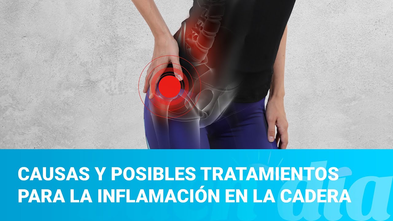 Causas y posibles tratamientos para la inflamación en la cadera