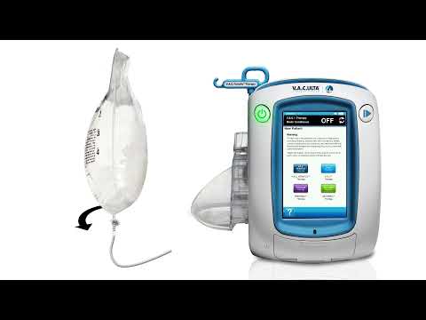 Initiate therapy: 3M™ Veraflo™ Therapy using Fill Assist