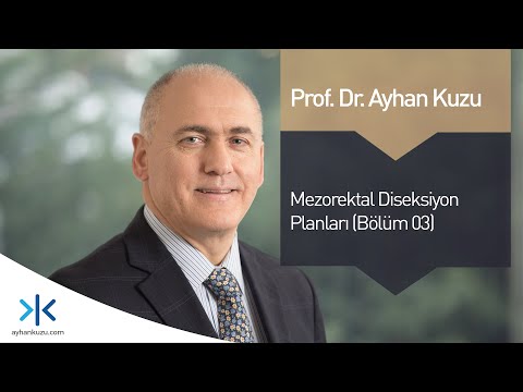 Mezorektal Diseksiyon Planları