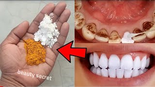 Teeth whitening and scaling at home in 1 minute, you will get pearl white teeth