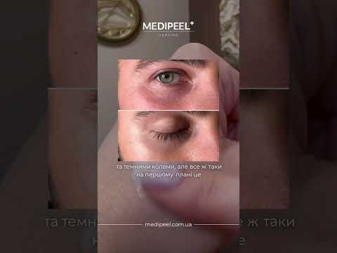 Medi Peel Peptide-Tox Bor Eye Cream (Peptide Bor-Tox Eye Cream)
