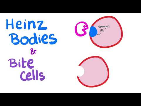 Heinz Bodies and Bite Cells - Abnormal Red Blood Cells (RBCs) - Hematology- Labs