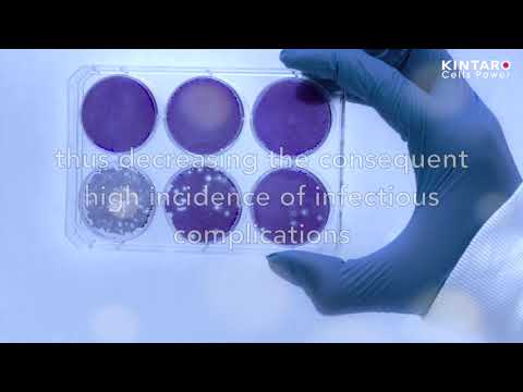 Mesenchymal Stem Cells (MSC) for Respiratory Diseases treatment