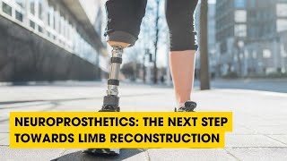 Podcast: Neuroprosthetics: The Next Step Towards Limb Reconstruction
