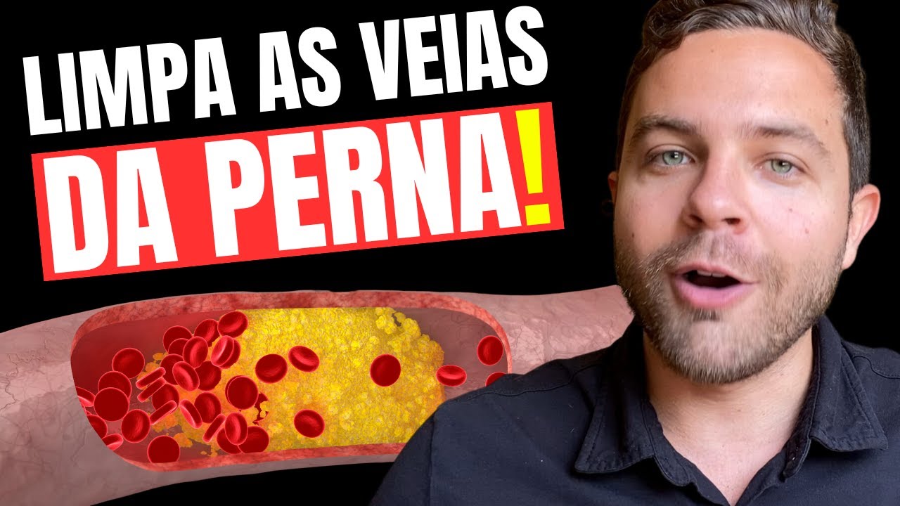 JUST ONE DRINK to FIGHT POOR CIRCULATION, VARICOSE VEINS and LEG PAIN