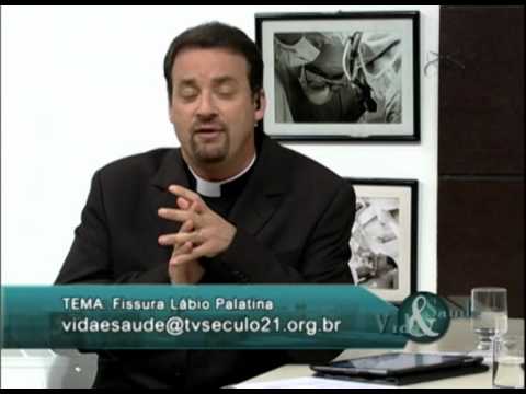 Vida e Saúde 17/09/2012 - Lábio Leporino 02