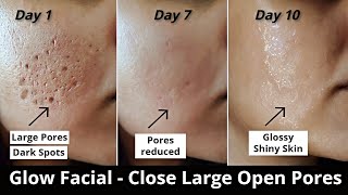 4 Step Glow Facial - Close Large OPEN PORES, Remove DARK SPOTS & get Glowing Skin - Aloevera icecube