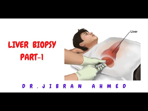 OSTEOGENIC TX II FLETCHERS 5TH E II ROBBINS 10TH E II POST GRADUATE LEARNING II DrJIBRANAHMED