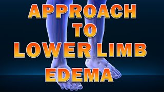 ازاي تتعامل مع حالات تورم القدمين ll Approach to Lower Limb Edema ll