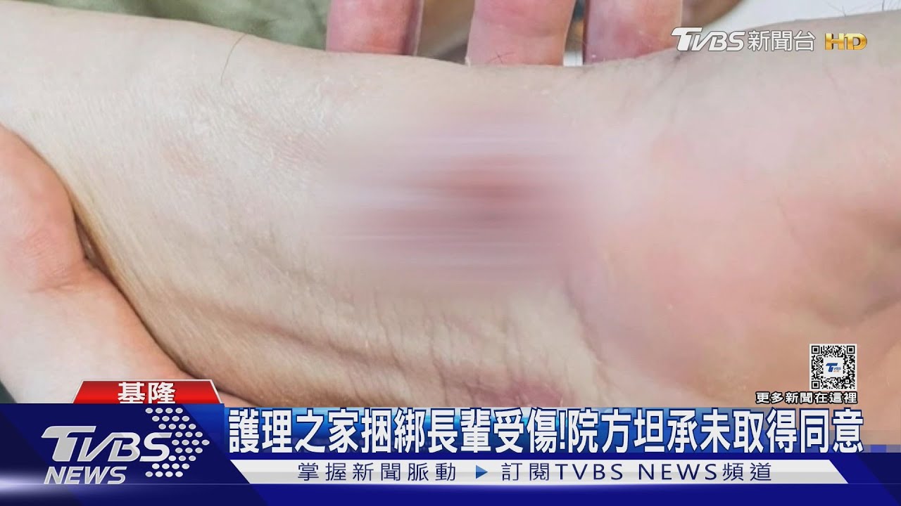 護理之家捆綁長輩受傷！　院方坦承未取得同意