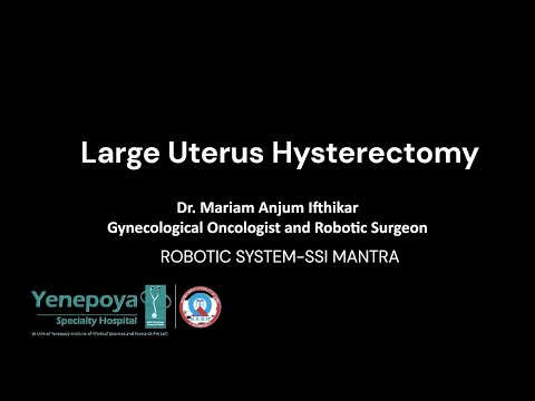 Large Uterus Hysterectomy on the SSI Mantra Robotic System