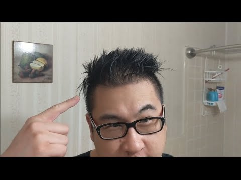 Die Schuppenflechte die Behandlung kartalinom Die Schuppenflechte der Nägel des Fotos die Beschreibung