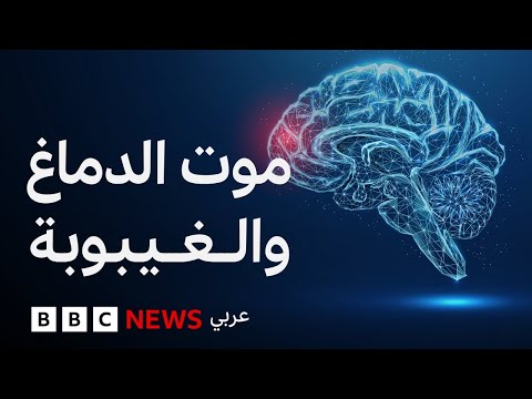 فيديو | ما الفرق بين الغيبوبة والموت الدماغي؟