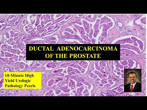 Prostatitis neurózis