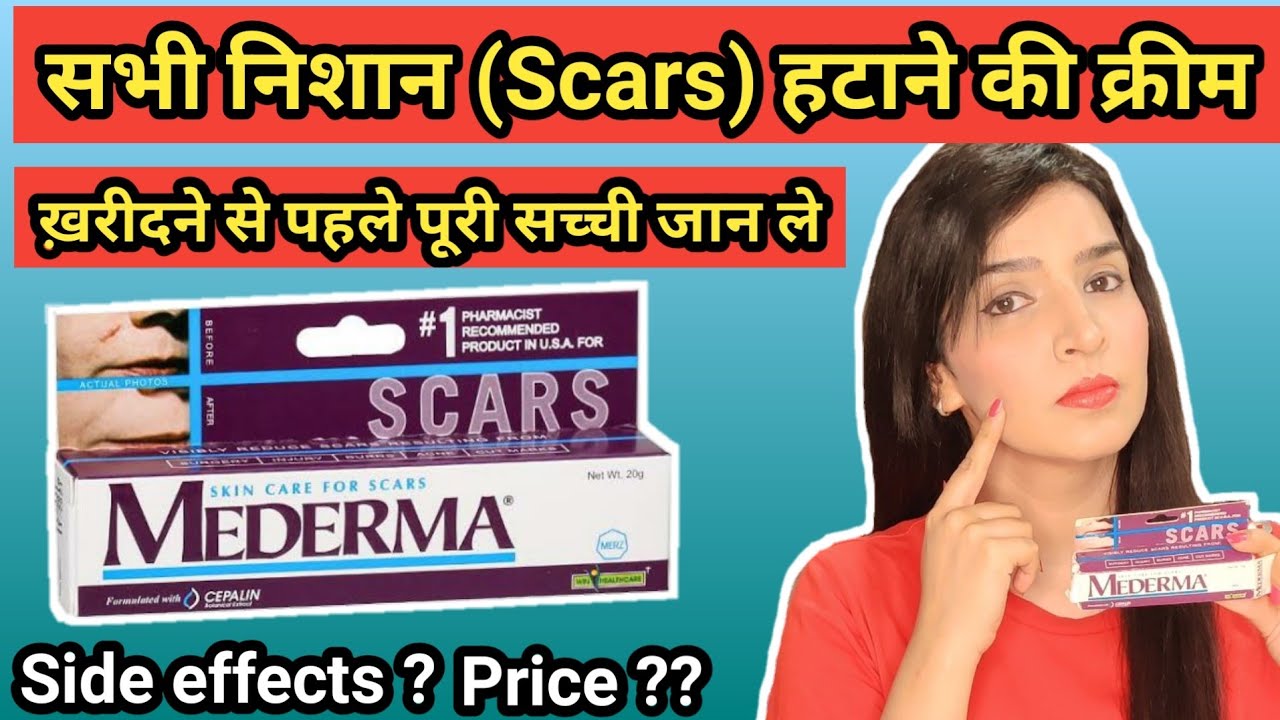 Mederma cream | mederma for acne scars | mederma advanced scar gel review