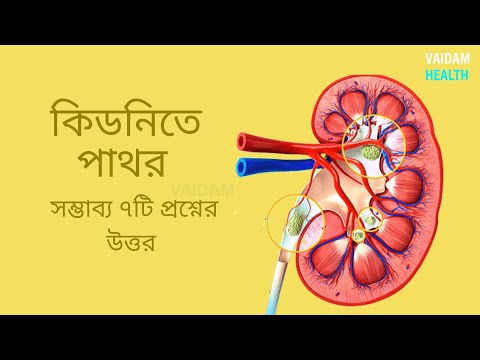 কিডনিতে পাথর- প্রায়শই জিজ্ঞাসিত প্রশ্ন