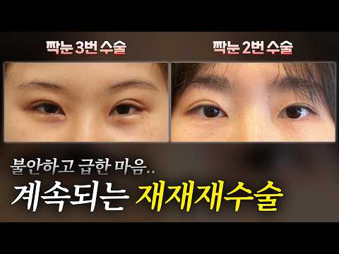 마음은 급하고 재수술은 해야겠고..그런데 짝눈은 계속 그대로?... · 韩语