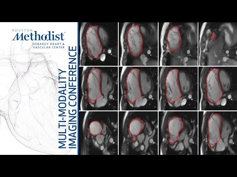 Assessment of the Right Ventricle and Right Sided Valves: CMR (Eric Yang, MD, PhD) March 2, 2021