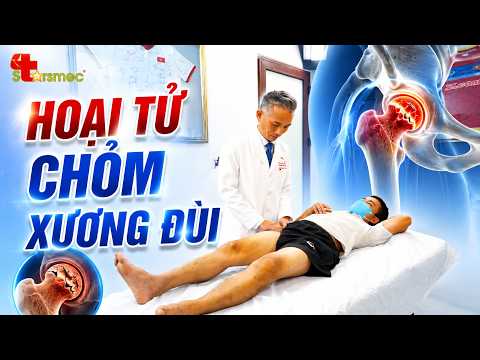 Hoại Tử Chỏm Xương Đùi – Đừng Đợi Đến Khi Khập Khiễng Mới Đi Khám!