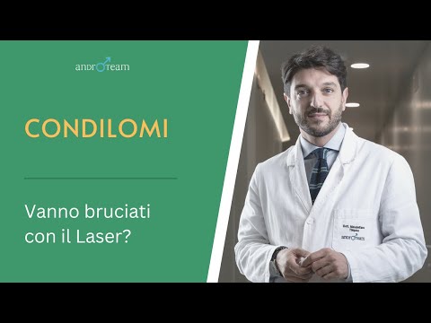I CONDILOMI vanno bruciati con il LASER? | AR 66