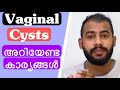 Vaginal Cysts | യോനി സിസ്റ്റുകൾ| Malayalam Health Tips